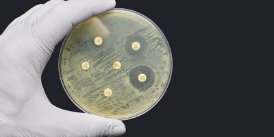 UK (University of East Anglia) Tracking the global spread of antimicrobial resistance