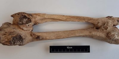 UK (Queen’s University Belfast) Genetic causes of bone tumours discovered in 1,000-year-old Irish skeletons